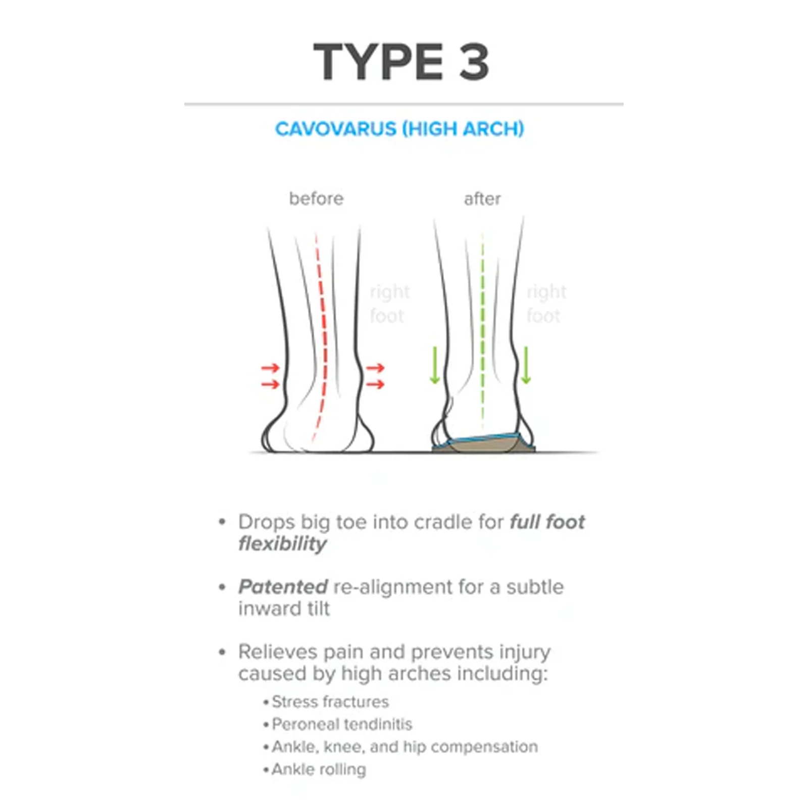 Foot Scientific Arches Type 3 Supination/High Arch Orthotic (Unisex) - Image 3